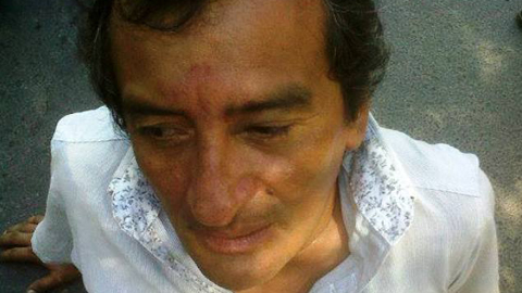 Víctor Gamboa luego de ser golpeado. Foto gentileza de El Acople informativo